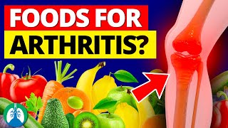 Eat THESE AntiInflammatory Foods Daily to Help Cure Arthritis Symptoms [upl. by Ditter793]