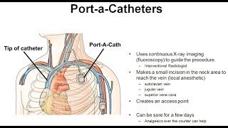 24 Principles of Port A Cath Placement amp Management [upl. by Ecined]