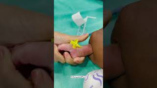 Bandeya 💉🌡️✌️ ivcannulation newbornbaby babydocter ytshorts kidsvideo injection viralvideo [upl. by Allista]