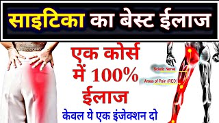 साइटिका दर्द का बेस्ट ईलाज  Sciatica pain Treatment  best sciatica medicine  sciatica [upl. by Eelitan680]