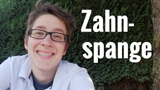 Vlog 108  ZahnspangenTalk [upl. by Orvah814]