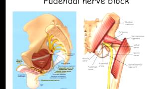 Pain Medicine  Lateral Femoral Cutaneous Nerve Pudendal Nerve [upl. by Moina]