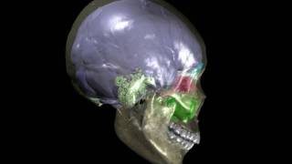 Human skull with brain endocast paranasal sinuses amp mastoid sinuses [upl. by Peedsaj]