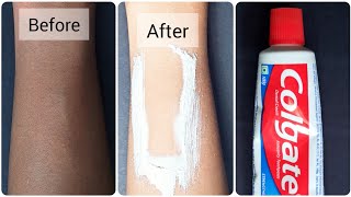 best colgate toothpaste beauty hacks and tips for face and skin whitening [upl. by Aniuqal]