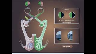 Visual Neural Pathways and Visual Field Defects [upl. by Adivad719]