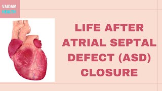 Life after Atrial Septal Defect Closure [upl. by Eeram]