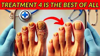 How to Get Rid of Nail Fungus Fast Top 6 Effective Treatments [upl. by Lamiv]