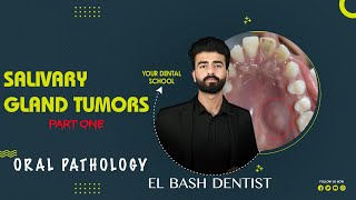 benign salivary gland tumors  oral pathology  عزت شومان [upl. by Lednyk]