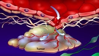 Introduction to Cancer Biology Part 4 Angiogenesis [upl. by Warfourd200]