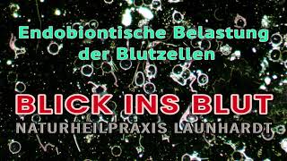 Blick ins Blut  Endobiontisch belastete Blutzellen [upl. by Yllut]