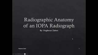 Intraoral Periapical X Ray Radiographic Anatomy [upl. by Constantin]