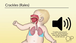 Respiratory Assessment by B Leary L DelSignore  OPENPediatrics [upl. by Wilkie]