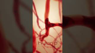 Sickle cell disease animation  sicklecelldisease SickleCellAnemia hemolysis medicalanimation [upl. by Peednam]