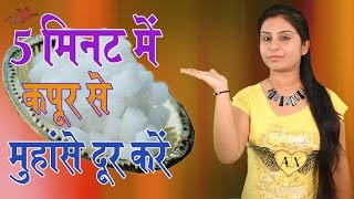 5 मिनट में कपूर से मुंहासे दूर करें Beauty Benefits Of Camphor  Removes Acne amp Scars From Skin [upl. by Malvie929]