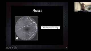 Retinal Vascularization amp FFA Mohammad Eko Prayogo [upl. by Ameen]