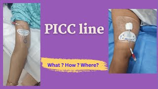 PICC Line Insertion  Patient Education video [upl. by Ahsiri]