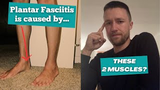 Your Podiatrist Never Mentioned These 2 Muscles [upl. by Norword]