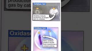 Catalase and oxidase test [upl. by Einnhoj]