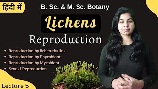 LICHEN PLANUS amp LICHENOID REACTIONS [upl. by Nebuer406]