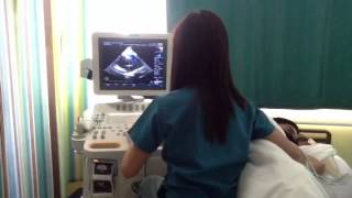 2D Echo with Doppler Test [upl. by Marcelia116]