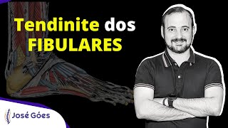 Tendinite dos FIBULARES  José Góes [upl. by Waddle138]