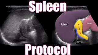 Spleen Protocol [upl. by Irollam]