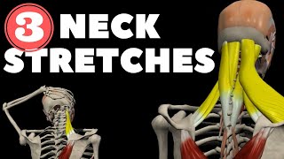 Neck Stretches for Instant pain relief [upl. by Valerio886]