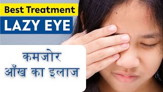 Lazy Eye Amblyopia Symptoms Causes amp Treatment कमजोर आँख का सही इलाज  Exercises for Lazy eye [upl. by Patten685]