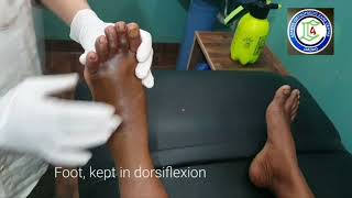 Traumatic Ankle Dislocation  Ankle Subluxation reduction  Closed reduction Ankle  Adamya Hosp Vid [upl. by Schwarz920]