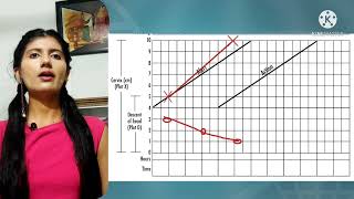 partograph explained [upl. by Doty]