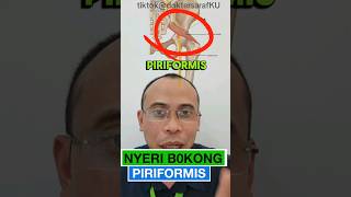 Kenali Gejala Awal Piroformis Sindroma Nyeri Bokong Mirip Saraf Kejepit Pinggang [upl. by Eseela]