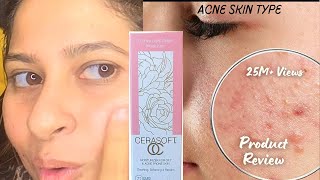 Acne skincare moisturiser  say goodbye 👋 to Dry skin cerasoft Beauteousskin moisturiser [upl. by Lytton]