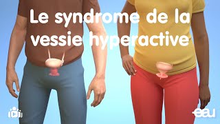 Le syndrome de la vessie hyperactive OAB pour overactive bladder [upl. by Calder713]