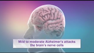 Alzheimers Disease Explained in 6 minutes with Animation [upl. by Lengel]