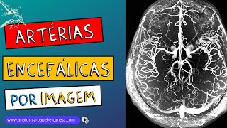 ANGIOGRAFIAS  ARTERIOGRAFIAS  ARTÉRIAS do encéfalo na imagem [upl. by Ggerg195]