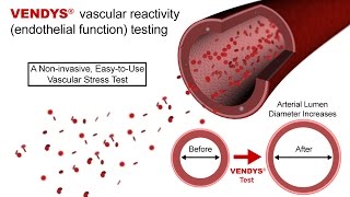 VENDYS  Endothelial Function Measurement Explained [upl. by Rosenthal200]