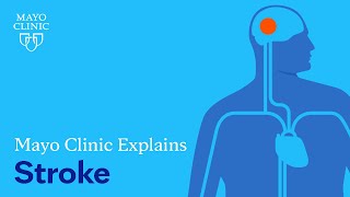 Mayo Clinic Explains Strokes [upl. by Deery]