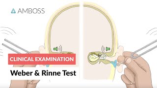 Weber and Rinne Test  Clinical Examination [upl. by Oz536]