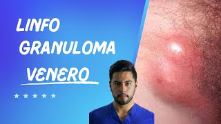 LINFOGRANULOMA VENEREO [upl. by Carmela258]