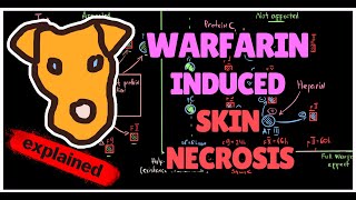 Pathogenesis of Warfarininduced skin necrosis Transient Hypercoagulation [upl. by Musihc]