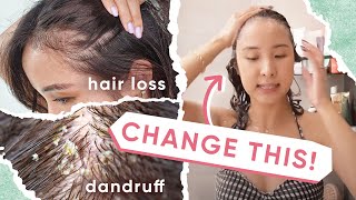 4 Reasons WHY Your Hair Loss amp Dandruff ISN’T Getting BETTER  5 TIPS [upl. by Esertap]