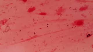 Gram positive cocci in sputum specimen I Gram stain [upl. by Lenoj]