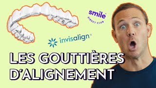 Les GOUTTIERES DALIGNEMENT DENTAIRE Invisalign Smile Direct ClubTout savoir sur lorthodontie [upl. by Halehs185]