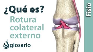 ROTURA DEL LIGAMENTO COLATERAL EXTERNO DE LA RODILLA  ¿Qué es [upl. by Ecirtra889]