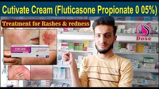 Cutivate Cream Fluticasone Propionate 0 05  Uses Side Effects Application  O Beauty Dose [upl. by Ellicul]