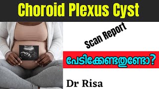 Choroid Plexus Cyst Malayalam  Anomaly Scan Report [upl. by Jae50]