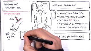 Diabetic Ketoacidosis Diabetes Type I Management Summary [upl. by Nilhsa]