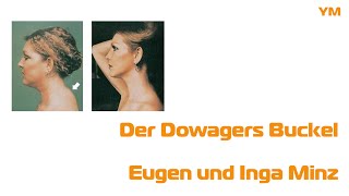 Der Dowagers Buckel  Eugen und Inga Minz [upl. by Enyr]