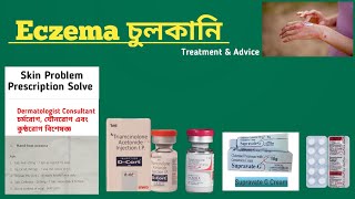 Hand Eczema Treatment চর্মরোগের ১০০ চিকিৎসা [upl. by Diarmit]