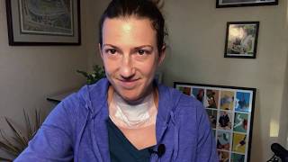 Full Recovery After Thyroid Surgery Including Videos from Post Op Days 2 4 6 and 14 [upl. by Aiuqat733]